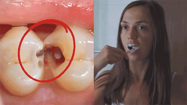 Red Dental Foam Banner