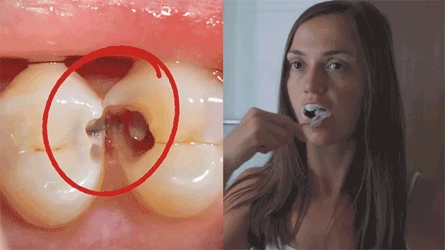 Red Dental Foam Banner